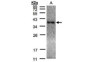 WB Image Sample(30 μg of whole cell lysate) A:Raji, 12% SDS PAGE antibody diluted at 1:5000 (EPM2A anticorps  (C-Term))