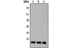 Western blot analysis of KLF10/11 expression in HEK293T (A), Raw264. (KLF10/11 anticorps  (C-Term))
