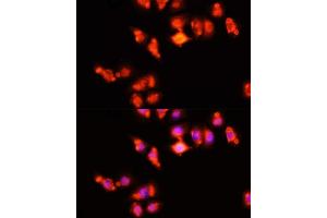 Immunofluorescence analysis of HeLa cells using HOX antibody (ABIN3017106, ABIN3017107, ABIN1680330 and ABIN6219956) at dilution of 1:100 (40x lens). (Homeobox A11 anticorps  (AA 1-180))