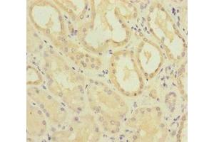 Immunohistochemistry of paraffin-embedded human kidney tissue using ABIN7159655 at dilution of 1:100 (MMACHC anticorps  (AA 63-282))