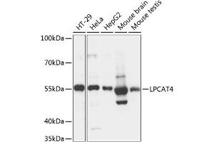 Western blot analysis of extracts of various cell lines, using LPC antibody (ABIN7268338) at 1:3000 dilution. (LPCAT4 anticorps  (AA 345-524))