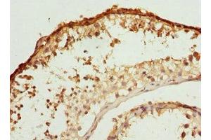 Immunohistochemistry of paraffin-embedded human testis tissue using ABIN7145239 at dilution of 1:100