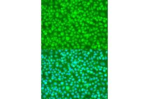 Immunofluorescence analysis of U2OS cells using N4BP1 antibody.