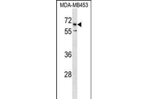 CATSPER2 Antibody (C-term) (ABIN1537377 and ABIN2850383) western blot analysis in MDA-M cell line lysates (35 μg/lane). (CATSPER2 anticorps  (C-Term))