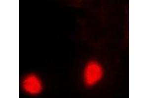 Immunofluorescent analysis of PSMD10 staining in Hela cells. (PSMD10 anticorps)