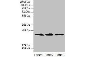 Western blot All lanes: CLDN20 antibody at 4 μg/mL Lane 1: A549 whole cell lysate Lane 2: HepG2 whole cell lysate Lane 3: PC-3 whole cell lysate Secondary Goat polyclonal to rabbit IgG at 1/10000 dilution Predicted band size: 24 kDa Observed band size: 24 kDa (Claudin 2 anticorps  (AA 29-81))