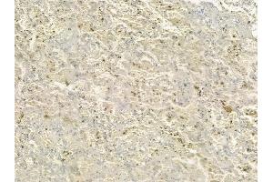 ABIN6258660 and ABIN6274798 at 1/100 staining human normal lung tissue by IHC-P. (ACSS1 anticorps  (C-Term))