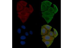 ABIN6255732 and ABIN6267570 staining Hela cells(30 min of UV treatment) by IF/ICC. (ADAM17 anticorps  (pThr735))