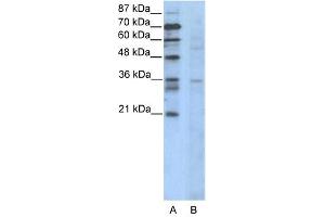 CCNB3 antibody (20R-1100) used at 0. (Cyclin B3 anticorps  (N-Term))