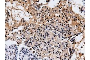 Immunohistochemistry (IHC) image for anti-5'-Nucleotidase Domain Containing 1 (NT5DC1) antibody (ABIN1499837)