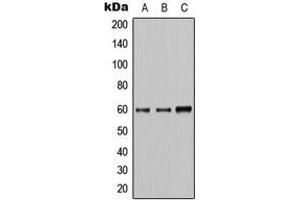 Western blot analysis of AKT expression in HeLa (A), A549 (B), HepG2 (C) whole cell lysates. (AKT1 anticorps  (Center))