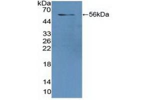 Detection of Recombinant GR, Human using Polyclonal Antibody to Glutathione Reductase (GR) (Glutathione Reductase anticorps  (AA 44-522))