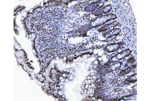 IHC analysis of CTBP2 using anti-CTBP2 antibody (ABIN7601326). (CTBP2 anticorps  (AA 321-445))