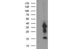 Western Blotting (WB) image for anti-PDZ and LIM Domain 2 (PDLIM2) antibody (ABIN1500128) (PDLIM2 anticorps)