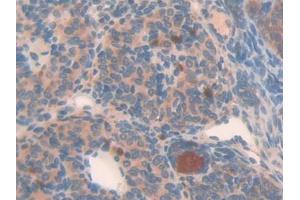 DAB staining on IHC-P; Samples: Mouse Placenta Tissue (NAIP anticorps  (AA 500-759))