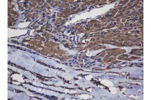 Immunohistochemistry (IHC) image for anti-Crystallin, alpha A (CRYAA) antibody (ABIN1498754)