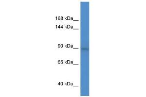 WB Suggested Anti-BCL11A Antibody Titration:  0. (BCL11A anticorps  (C-Term))