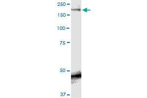 SCN9A monoclonal antibody (M01), clone 5A11.