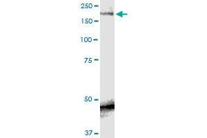 SCN9A monoclonal antibody (M01), clone 5A11. (SCN9A anticorps  (AA 269-339))