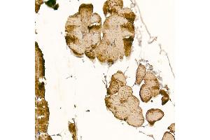 Immunohistochemistry of paraffin-embedded mouse skeletal muscle using CLCN1 Rabbit pAb (ABIN6130939, ABIN6138661, ABIN6138662 and ABIN6221409) at dilution of 1:200 (40x lens).