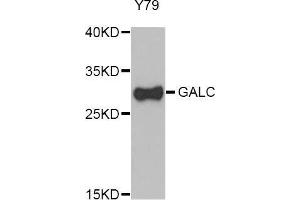 Western Blotting (WB) image for anti-Galactosylceramidase (GALC) (AA 40-300) antibody (ABIN1679950) (GALC anticorps  (AA 40-300))