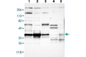 Western blot analysis of Lane 1: RT-4, Lane 2: U-251 MG, Lane 3: A-431, Lane 4: Liver, Lane 5: Tonsil with CCDC50 polyclonal antibody  at 1:250-1:500 dilution.