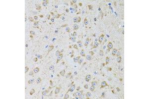 anti-Microsomal Triglyceride Transfer Protein (MTTP) antibody