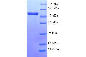 SDS-PAGE (SDS) image for Asialoglycoprotein Receptor 1 (ASGR1) (AA 61-284) protein (GST tag) (ABIN5709089) (Asialoglycoprotein Receptor 1 Protein (ASGR1) (AA 61-284) (GST tag))