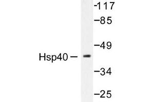 Image no. 2 for anti-DnaJ (Hsp40) Homolog, Subfamily B, Member 1 (DNAJB1) antibody (ABIN265471) (DNAJB1 anticorps)