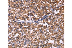 Immunohistochemistry of Human brain  using SELPLG Polyclonal Antibody at dilution of 1:50 (SELPLG anticorps)