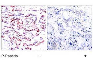 Image no. 1 for anti-Activating Transcription Factor 2 (ATF2) (pThr53), (pThr71) antibody (ABIN196667) (ATF2 anticorps  (pThr53, pThr71))