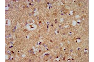 IHC image of ABIN7169072 diluted at 1:500 and staining in paraffin-embedded human brain tissue performed on a Leica BondTM system. (CDC42BPB anticorps  (AA 1609-1711))