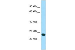 WB Suggested Anti-RAB41 Antibody Titration: 1. (RAB41 anticorps  (N-Term))