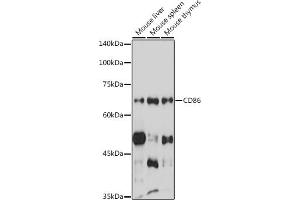 Western blot analysis of extracts of various cell lines, using CD86 antibody (ABIN6131556, ABIN6138237, ABIN6138238 and ABIN6219508) at 1:1000 dilution. (CD86 anticorps  (AA 30-247))