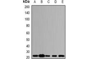 Western blot analysis of ALG-2 expression in SW620 (A), HepG2 (B), mouse kidney (C), mouse lung (D), rat ovary (E) whole cell lysates.
