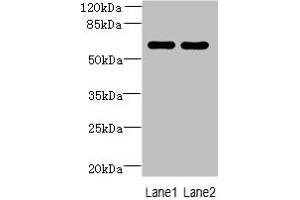 Western blot All lanes: ZNF215 antibody at 3 μg/mL Lane 1: Hela whole cell lysate Lane 2: A431 whole cell lysate Secondary Goat polyclonal to rabbit IgG at 1/10000 dilution Predicted band size: 61, 36 kDa Observed band size: 61 kDa (ZNF215 anticorps  (AA 12-304))