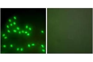 Immunofluorescence analysis of A549 cells, using Ku70/80 Antibody. (Ku70/80 (AA 683-732) anticorps)