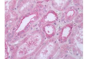 Human Kidney: Formalin-Fixed, Paraffin-Embedded (FFPE)