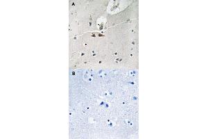 Immunohistochemical staining of human brain tissue by EFNB1/EFNB2/EFNB3 (phospho Y324) polyclonal antibody  without blocking peptide (A) or preincubated with blocking peptide (B) under 1:50-1:100 dilution. (Ephrin B1 anticorps  (pTyr324))