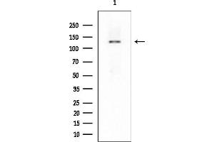 Western blot analysis of lysates from Rat liver, using TCIRG1 Mouse Monoclonal Antibody at 1/1000 dilution.