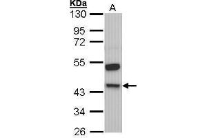 WB Image Sample (30 ug of whole cell lysate) A: Molt-4 , 10% SDS PAGE antibody diluted at 1:1000 (KNG1 anticorps)