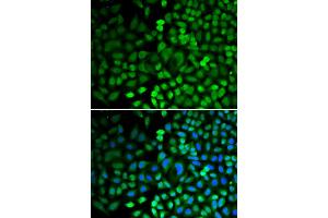 Immunofluorescence analysis of HeLa cells using APEX1 antibody (ABIN5970467). (APEX1 anticorps)