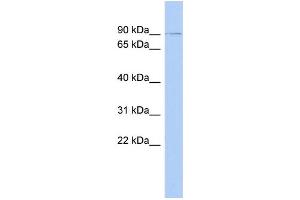 WB Suggested Anti-ZNF510 Antibody Titration:  0. (ZNF510 anticorps  (N-Term))