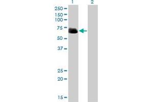 Western Blot analysis of RIPK2 expression in transfected 293T cell line by RIPK2 monoclonal antibody (M01), clone 2C7. (RIPK2 anticorps  (AA 431-540))