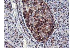 Immunohistochemical staining of paraffin-embedded Human pancreas tissue using anti-PFKP mouse monoclonal antibody. (PFKP anticorps)