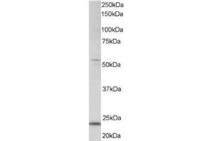 Image no. 1 for anti-MAX Dimerization Protein 4 (MXD4) (C-Term) antibody (ABIN374270) (MXD4 anticorps  (C-Term))