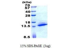 Figure annotation denotes ug of protein loaded and % gel used. (SAMD13 Protéine)