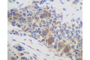 Image no. 3 for anti-Chemokine (C-X-C Motif) Ligand 14 (CXCL14) antibody (ABIN465239) (CXCL14 anticorps)