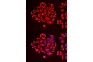 Immunofluorescence analysis of U2OS cells using TUFM antibody (ABIN5973823). (TUFM anticorps)