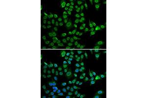 Immunofluorescence analysis of U2OS cells using LMNB2 antibody.